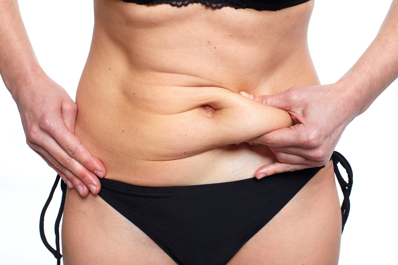 A MINI TUMMY TUCK IN JUST 2 HOURS (YES REALLY) – STUBBORN STOMACH SKIN BE GONE!