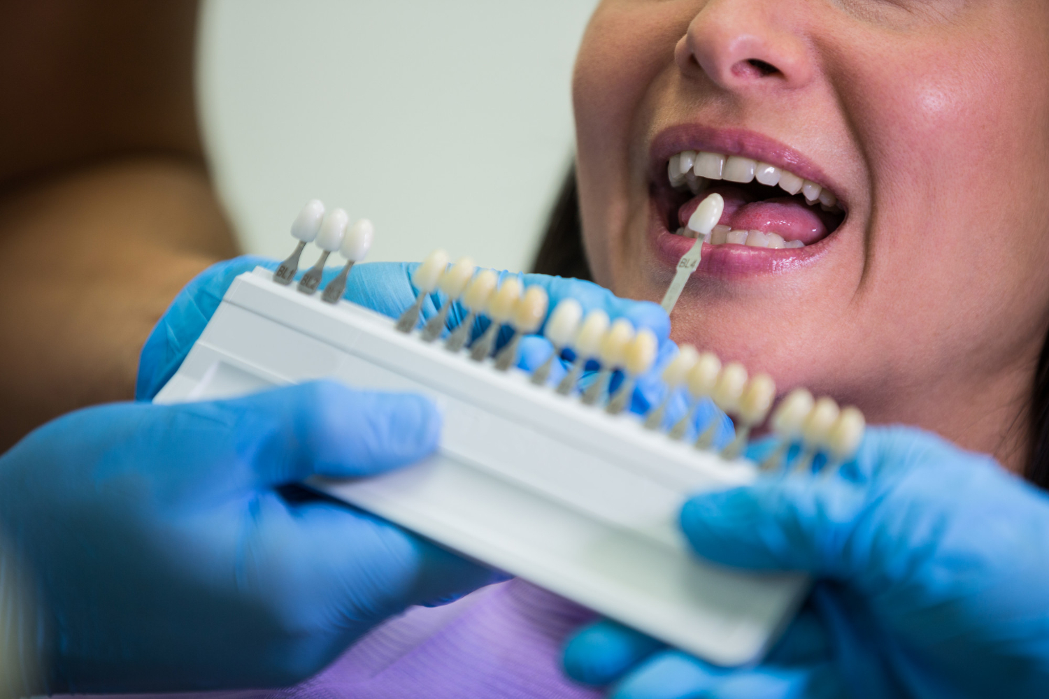All You Need To Know About Dental Crowns In Dubai