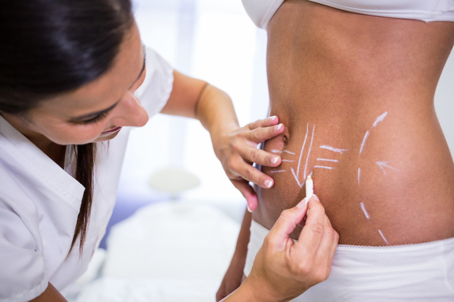 Let’s Understand 360 Liposuction Recovery Day By Day In Dubai