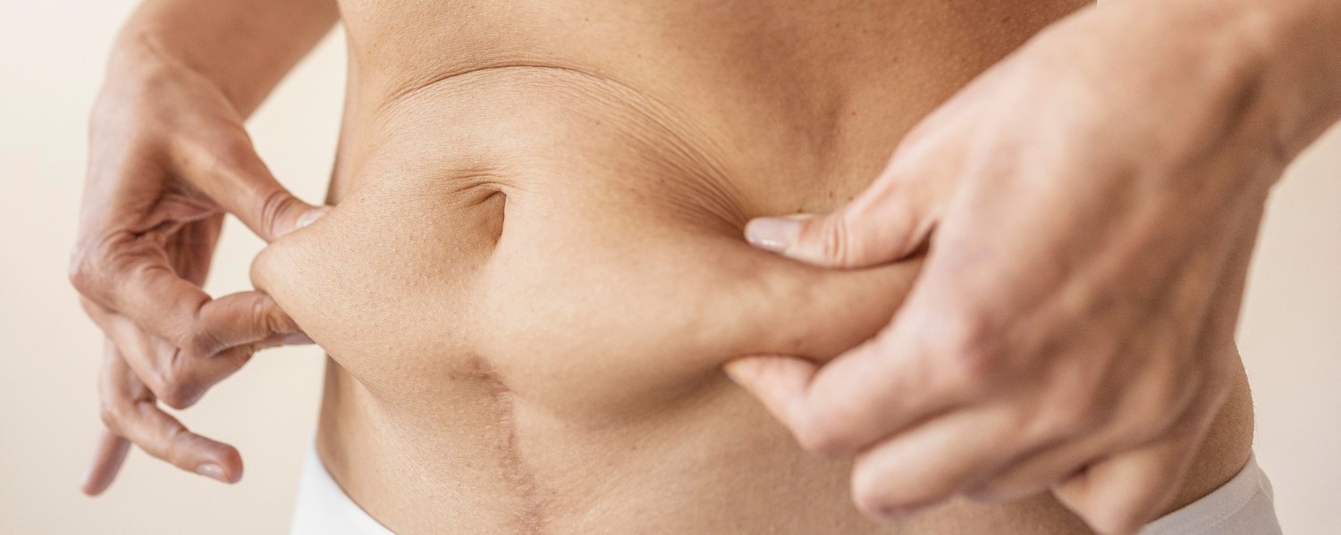 The Ultimate Guide to Tummy Tuck Surgery Types What to Expect