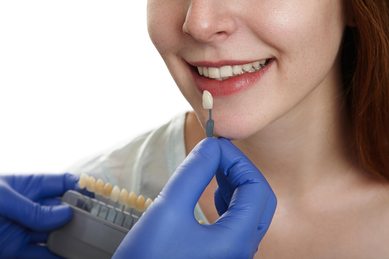 What to Expect at a Dental Crown Appointment In Dubai