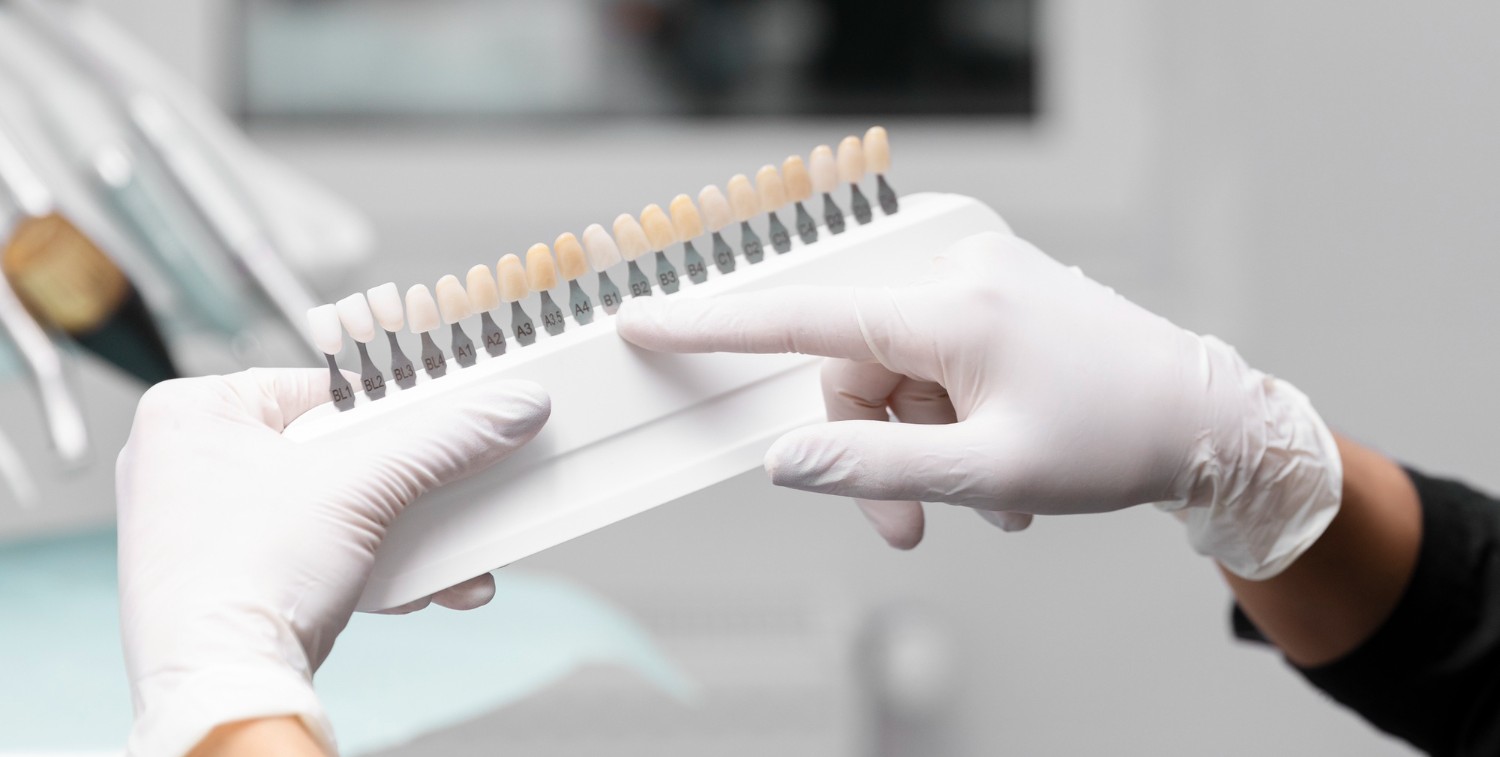 Veneers Dubai A Complete Guide