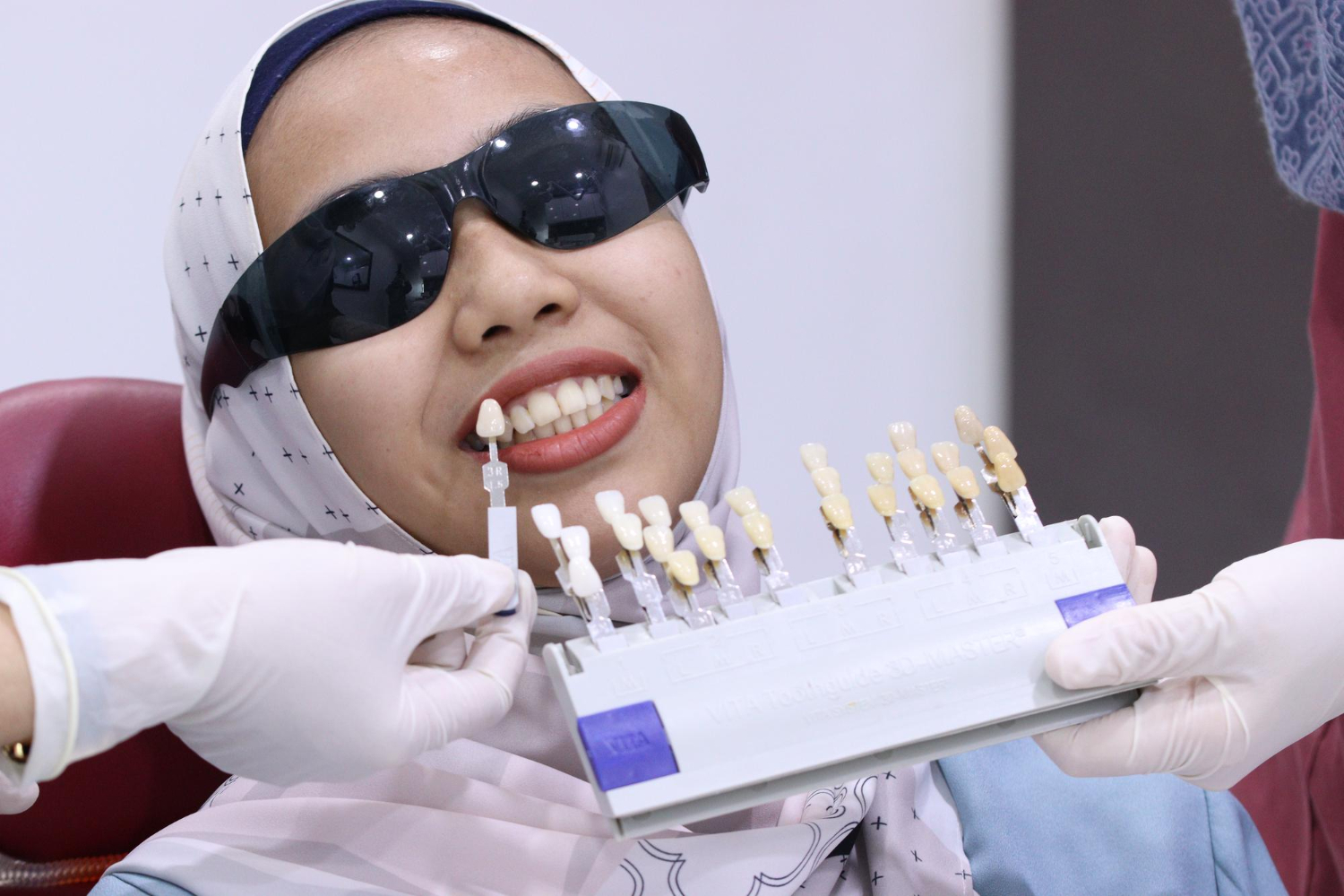 Tooth Crown Dubai A Guide to Different Types of Crowns